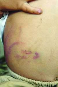 了4岁男孩小恩情因经常拉屎拉到裤里遭到舅