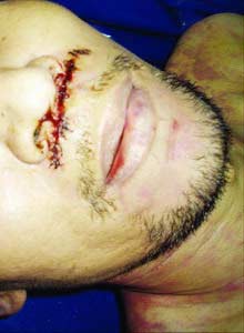 :死者黎朝阳系猝死